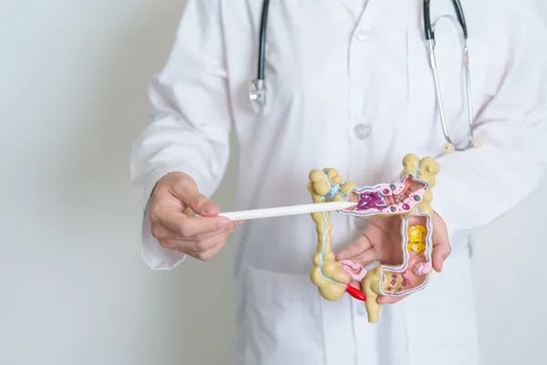 Colorectal Cancer
