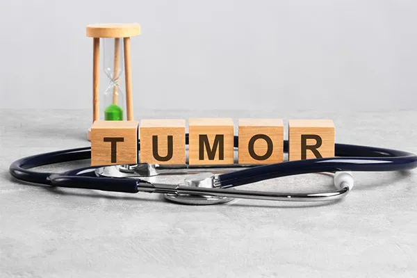 Multidisciplinary Tumor Boards