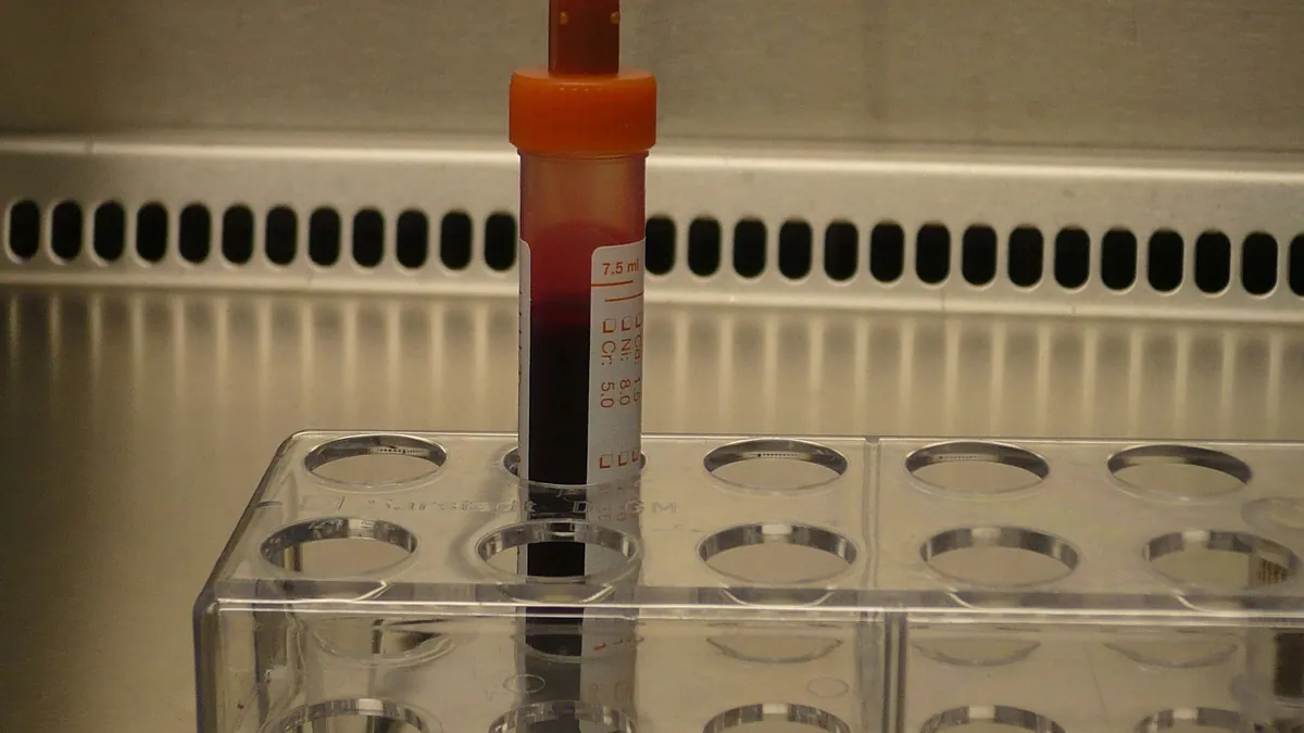 Blood test tubes prepared for an erythrocyte sedimentation rate test