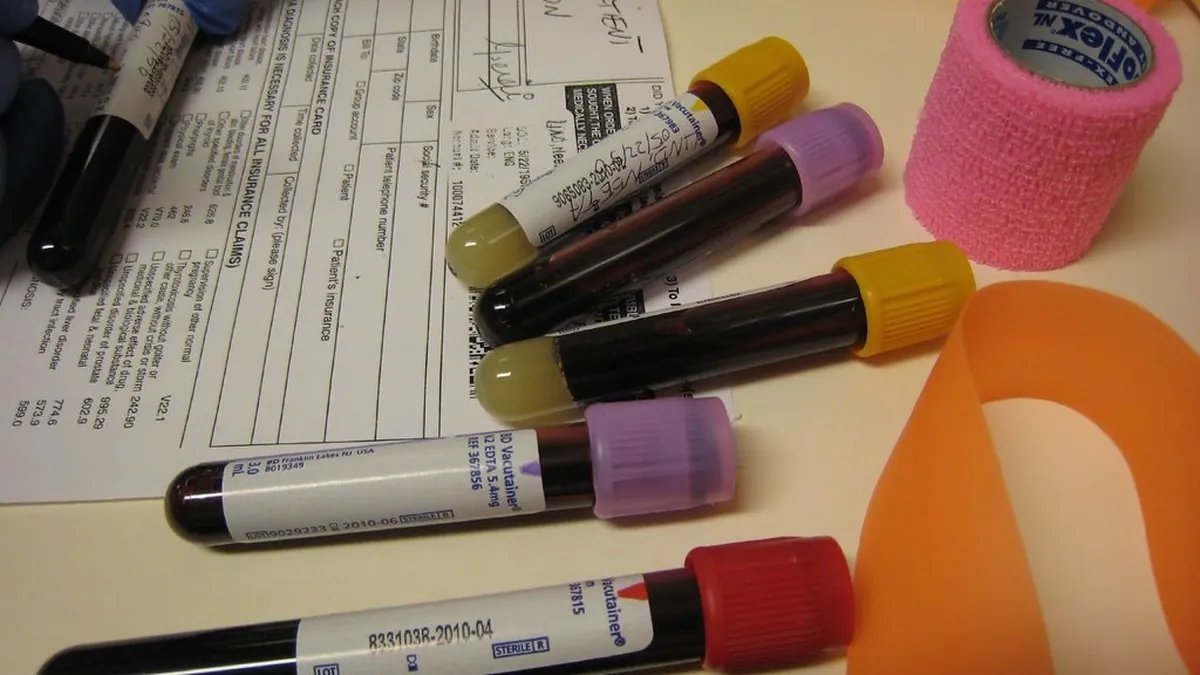 Blood sample tubes and a lab request form prepared for an ESR blood test