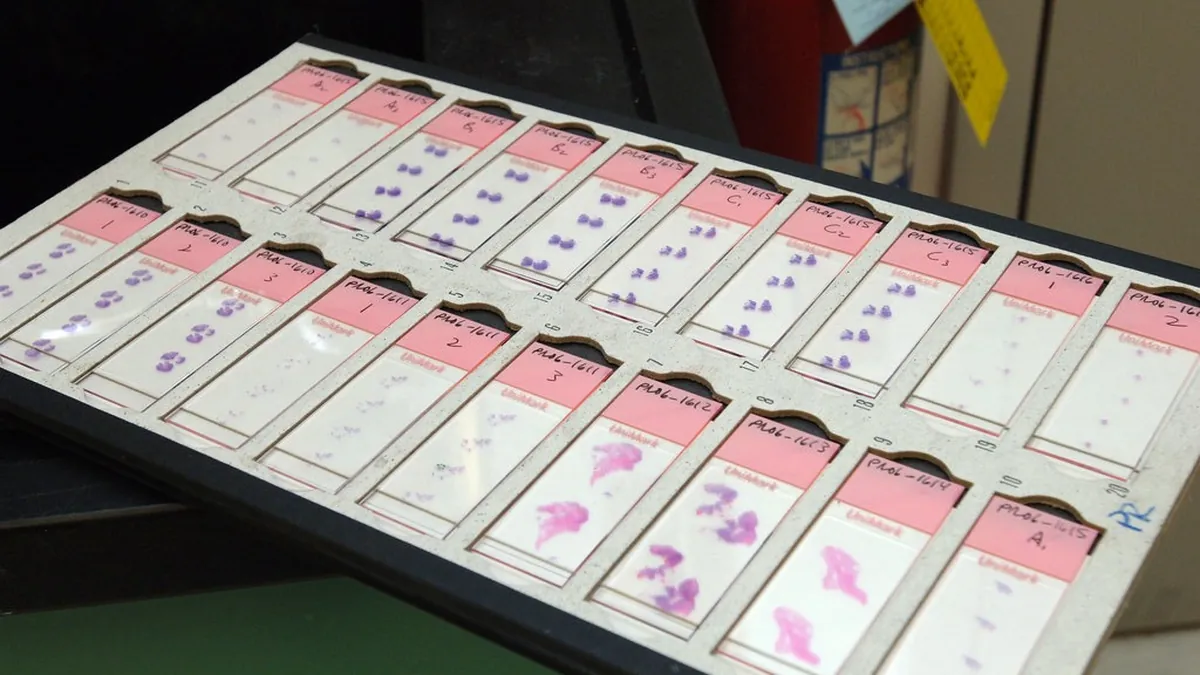 Tray of tumor tissue slides reviewed by a pathologist to guide personalized treatment
