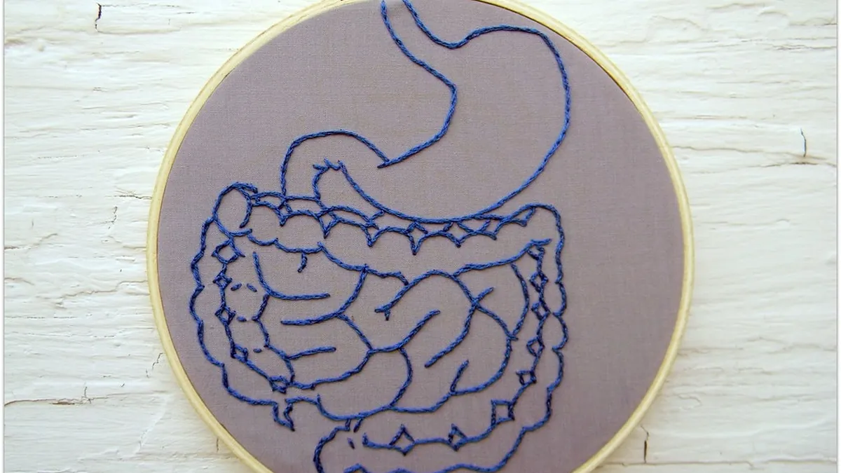 Anatomy illustration of the stomach showing where gastric cancer develops
