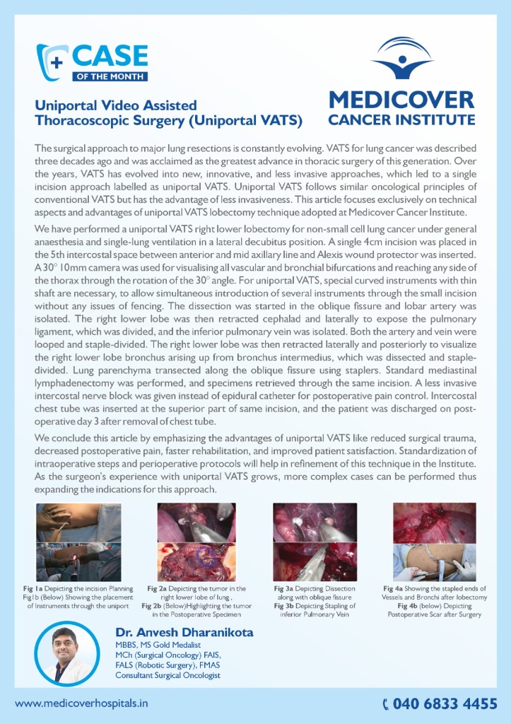 Case of the Month: Uniportal VATS